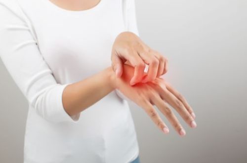 Eczema des mains une maladie difficile a vivre au quotidien