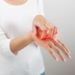 Eczema des mains une maladie difficile a vivre au quotidien